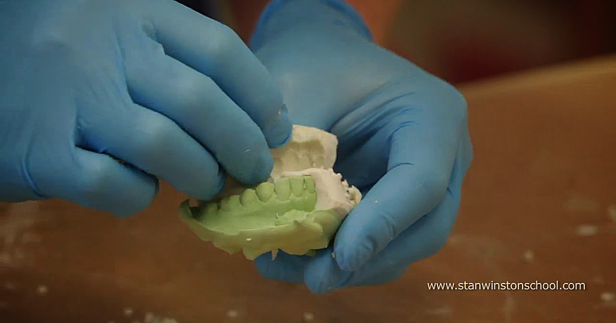 Dental Casting Techniques for Creating Fake Teeth FREE MiniLesson by